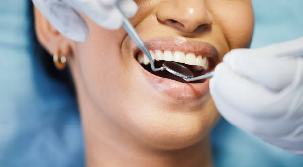 Best Emergency Dental Care for Broken or Chipped Teeth in Killeen, TX